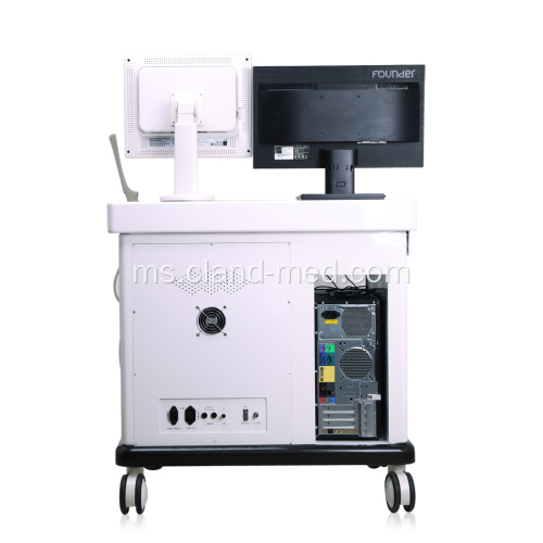 Mesin Ultrasound Troli Digital Hospital dengan Workstation